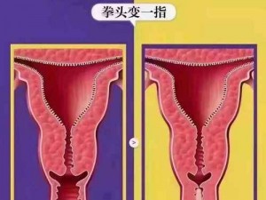 女人被深耕，一种新型女性私密健康养护方式，你了解吗？